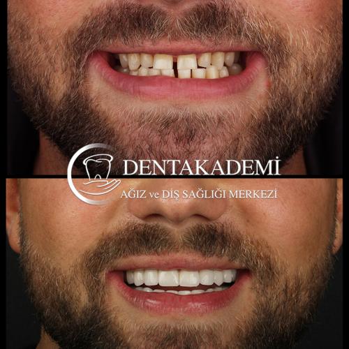 Before after photos of our patients 1